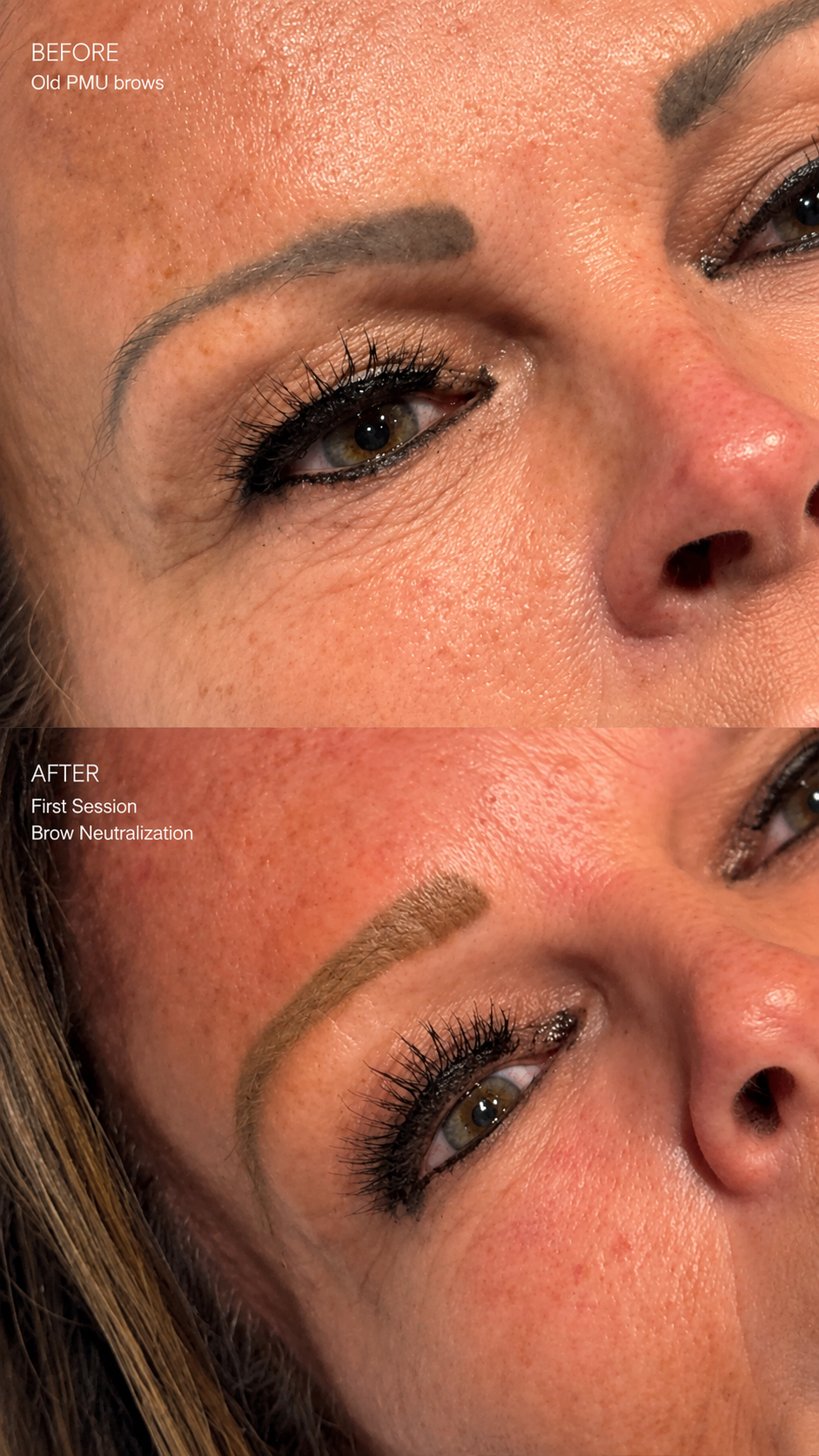 Grey Brow Neutralization